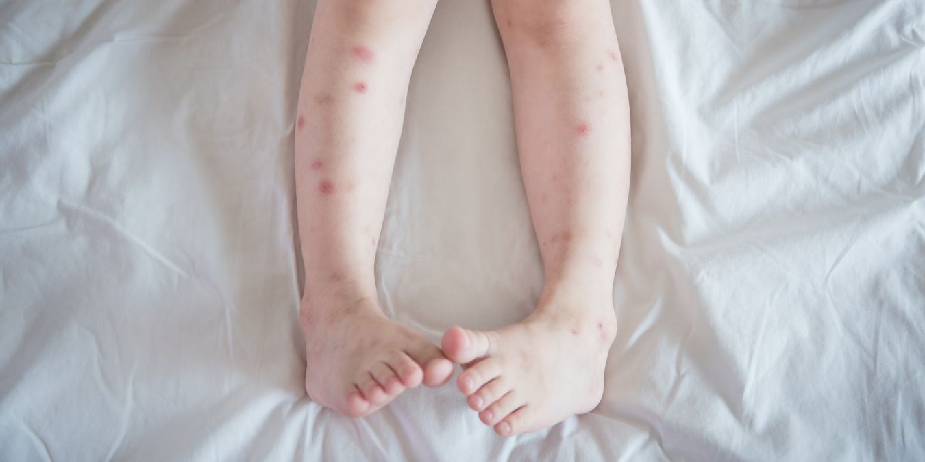 bed-bugs-ads132186212-1350×675 Bed Bugs Control Services Company - Pest Off Pest Control - Sherman Texas